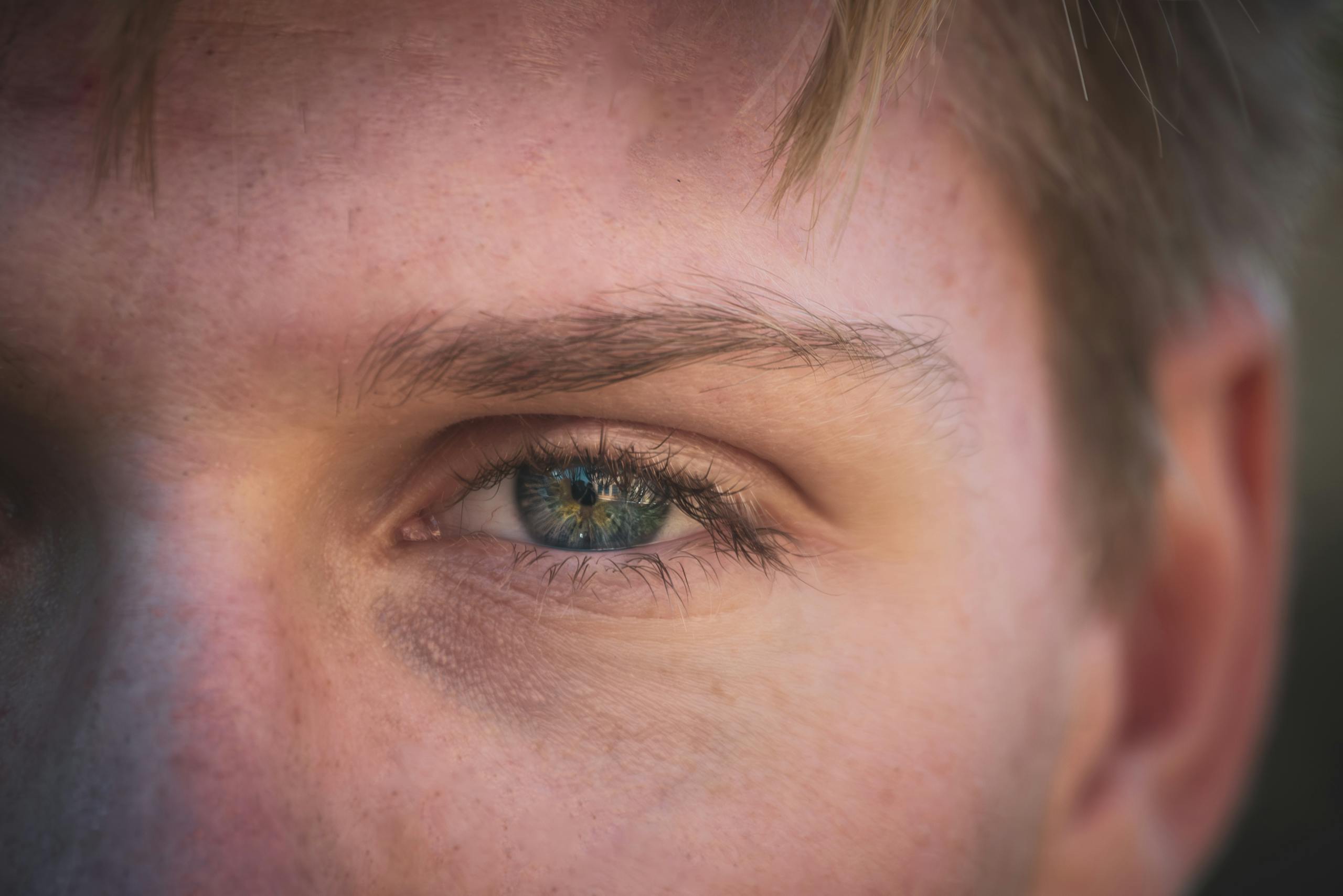 Detailed close-up of a caucasian man's green eye, showing texture and colors.